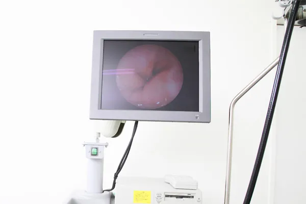 大腸内視鏡検査とは